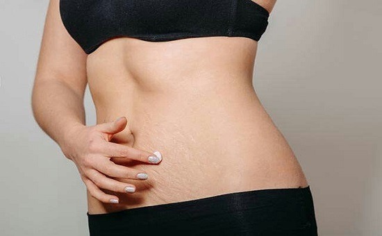 Belly Skin Care During Pregnancy