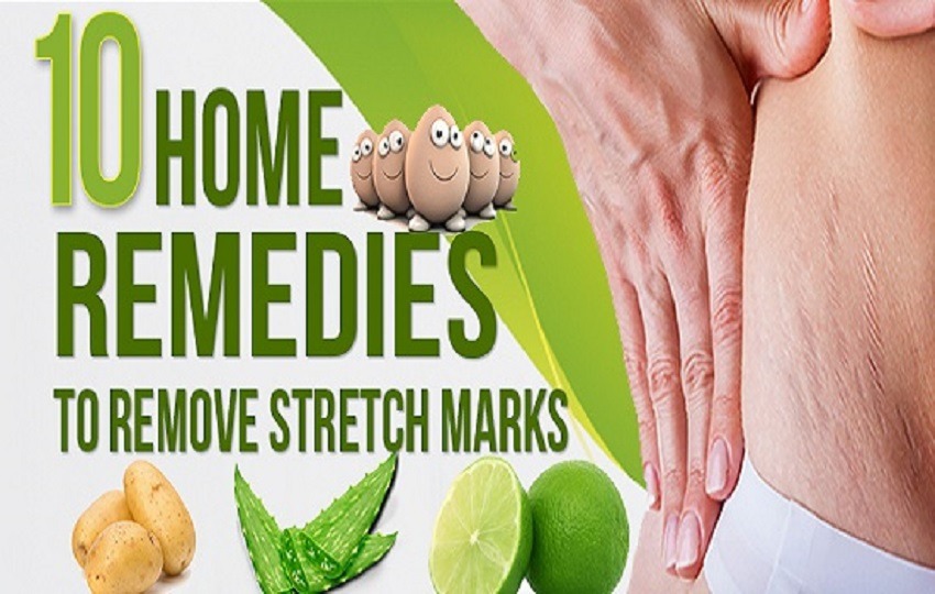 How To Remove Stretch Marks : Home Remedies