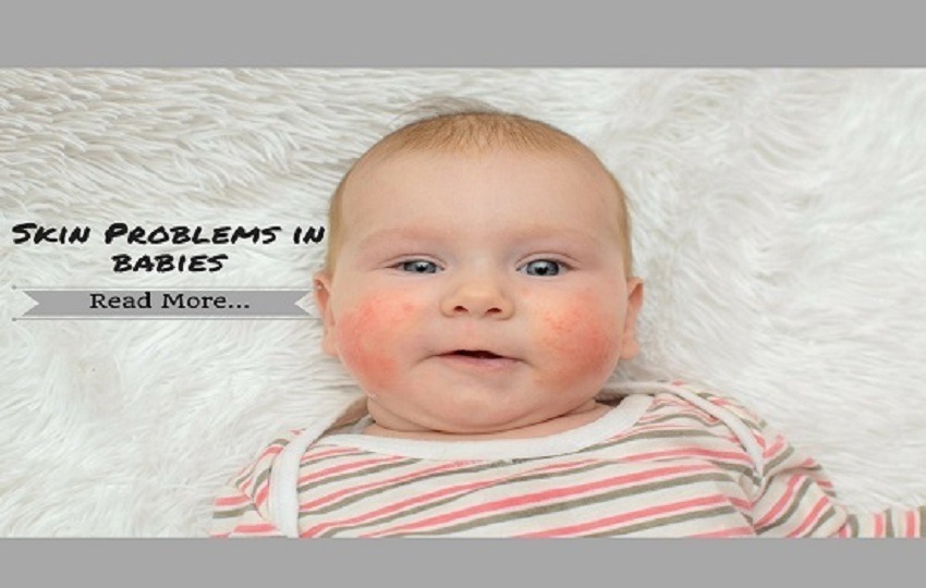 Skin Problems in Babies