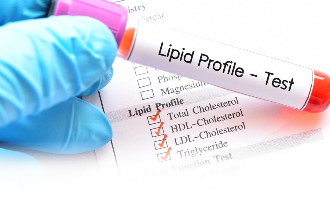 Details Of The Lipid Profile Test