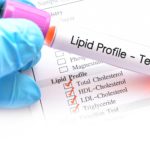 details of the lipid profile test