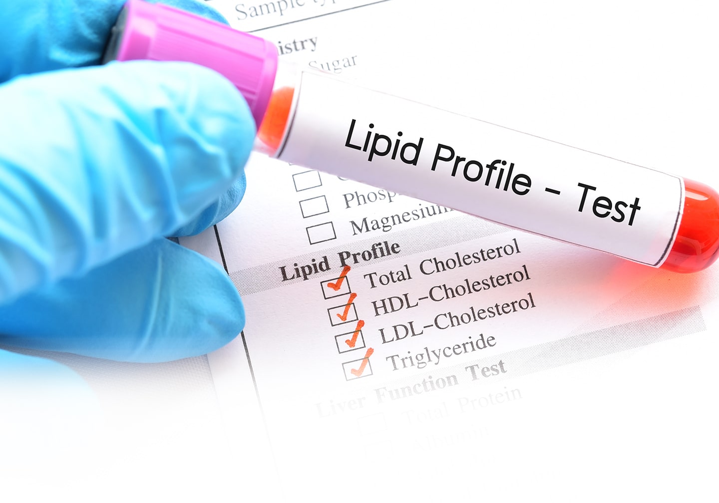 details of the lipid profile test