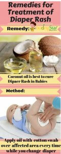 home-remedies-for-diaper-rash